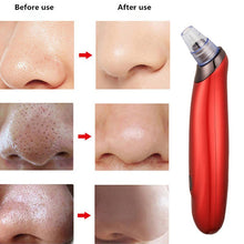 Load image into Gallery viewer, Vacuum Suction Facial Clean Machine